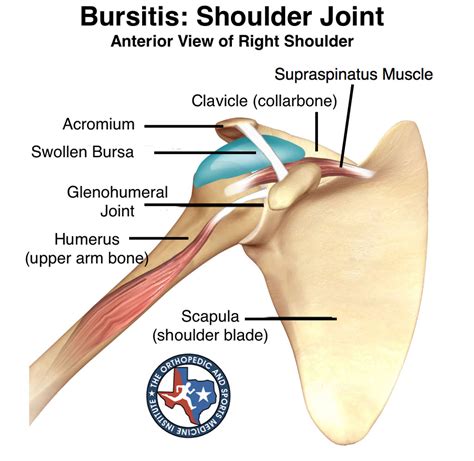 Removal of elbow bursa